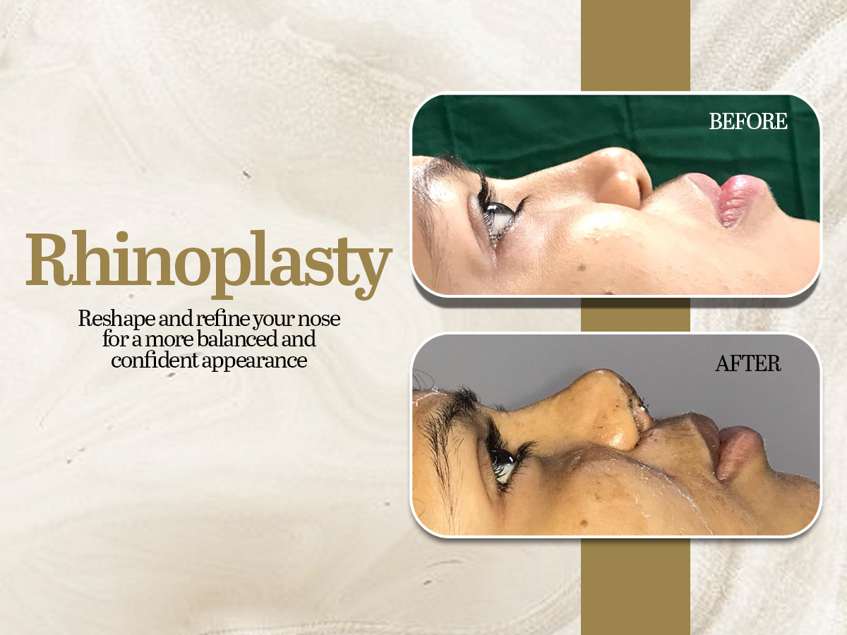 Lucknow Plastic Surgery Clinic Facility Banner