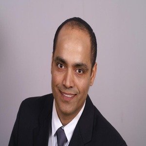 Microscopic FUE Hair Transplant — after
